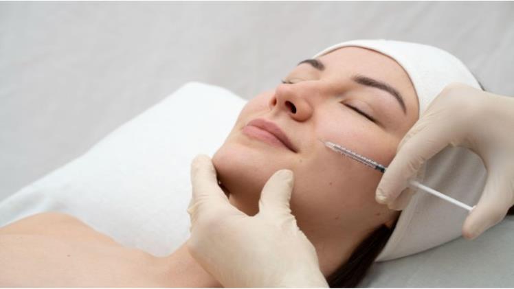 Nasolabial Fold Filler Procedure