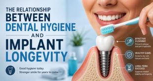 The Relationship Between Dental Hygiene And Implant Longevity