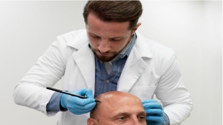 Hair Transplant